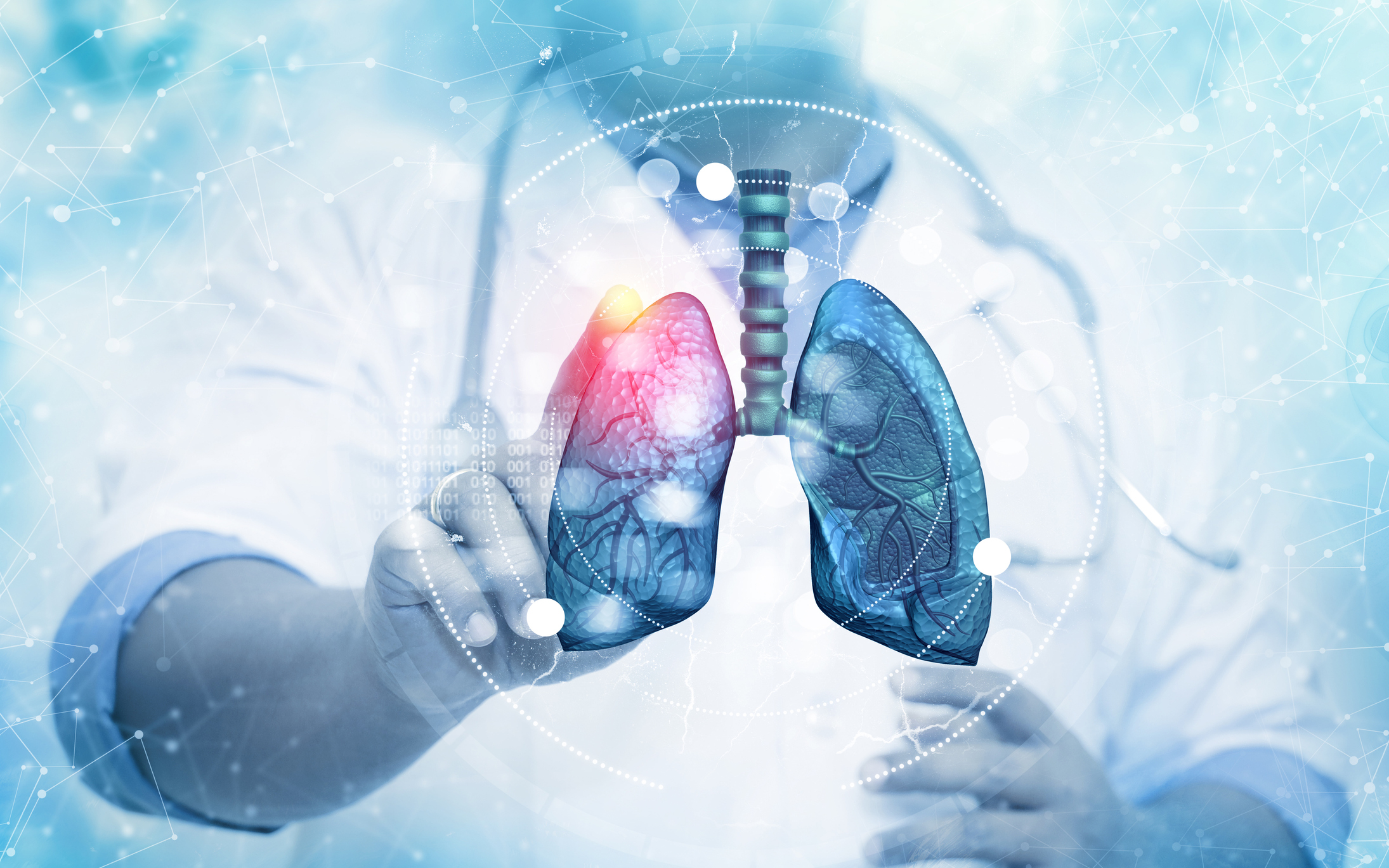 5 Early Signs of Lung Cancer image