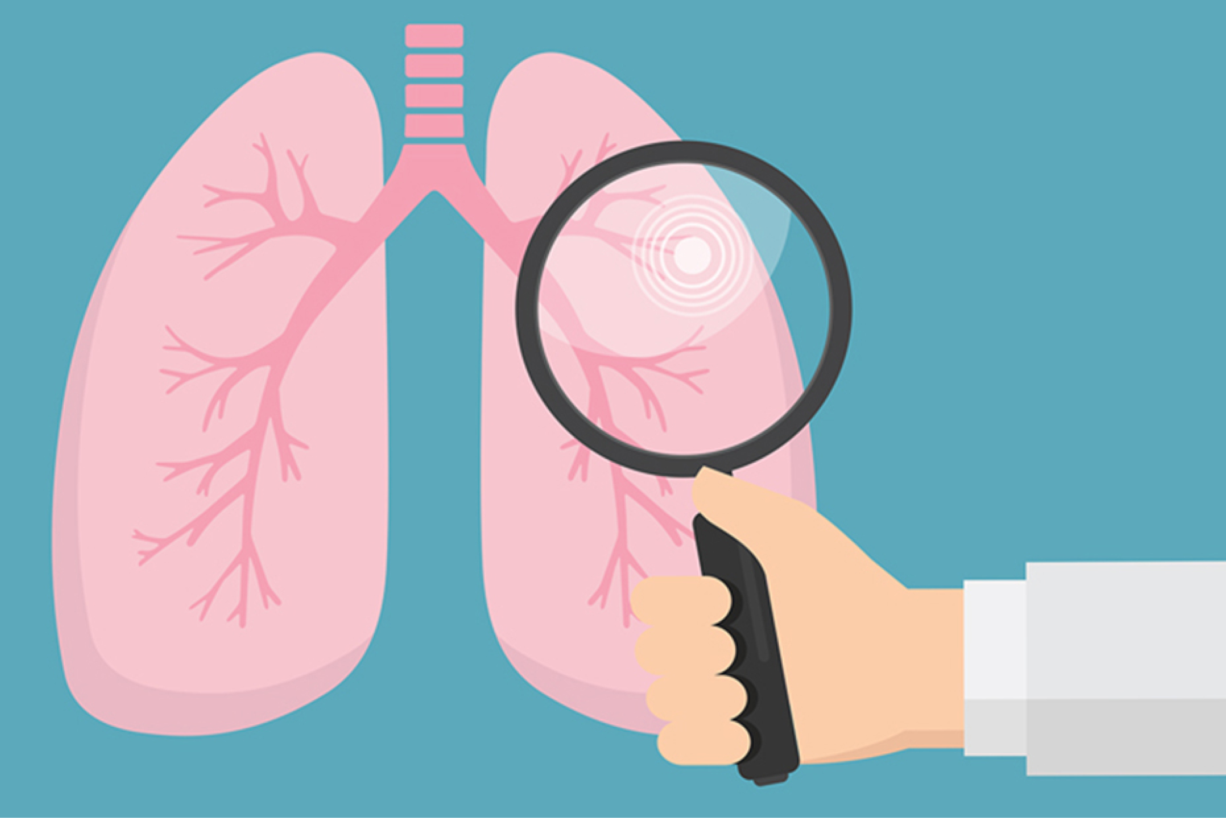 Men’s Health Month and Lung Cancer Screening image