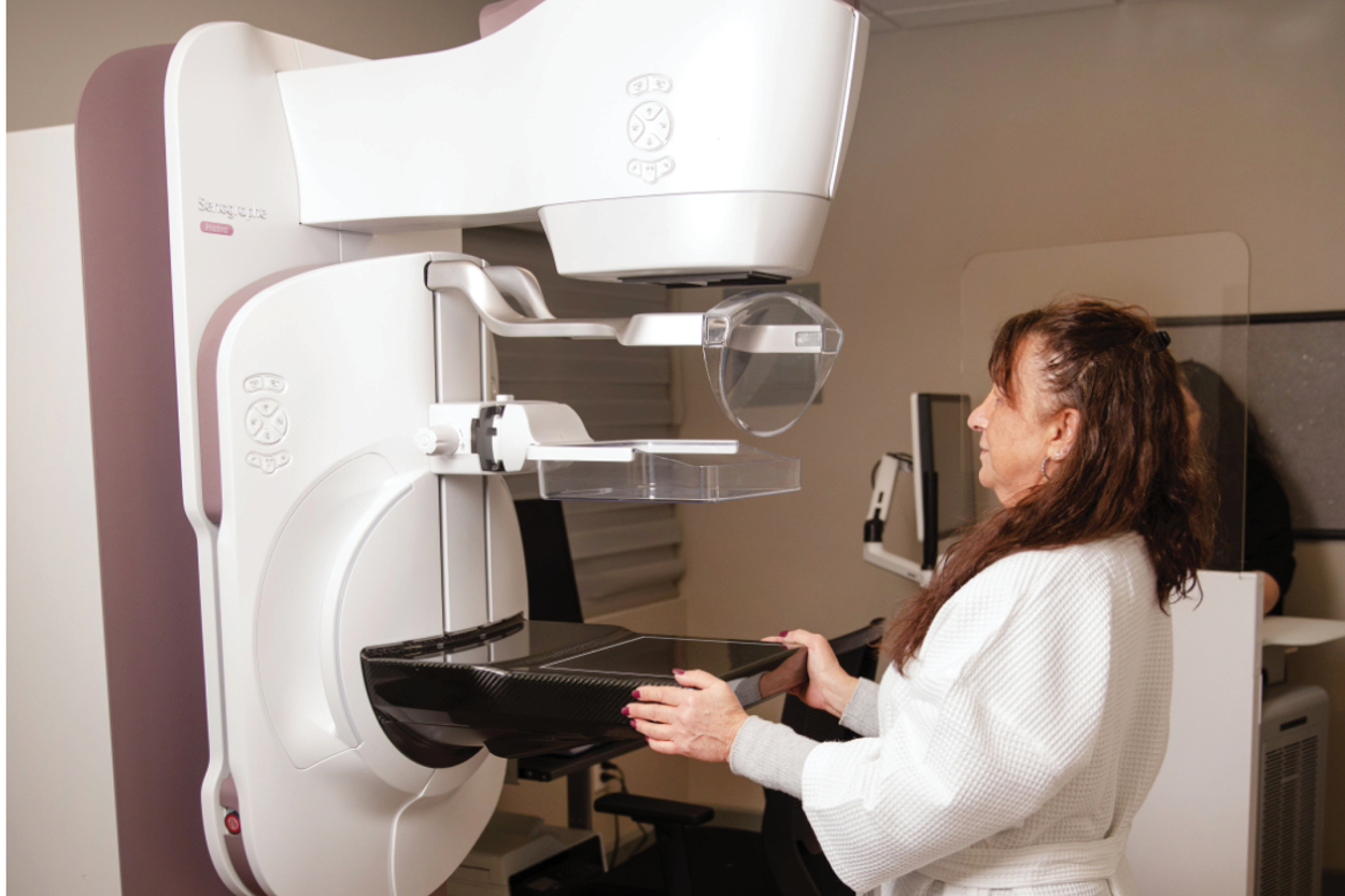 What is a Baseline Mammogram? image