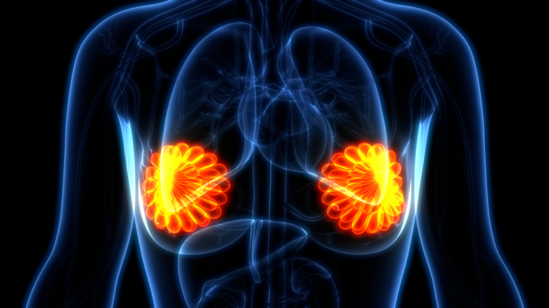 The Role of Breast Cancer Classification as a Guide to Therapy image