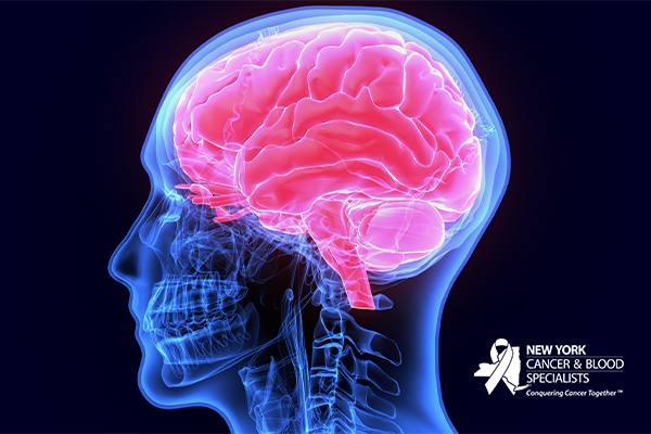 Understanding Your Brain Cancer Treatment Options image