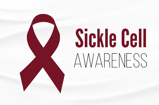 What is Sickle Cell Disease image